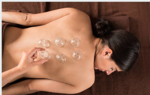 cupping