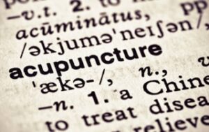 what-is-acupuncture-img-320x202